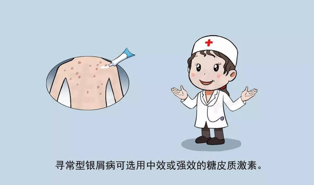 银屑病会不会传染