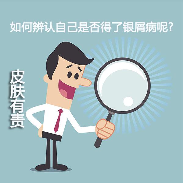 男性得了银屑病治疗方法
