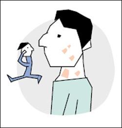 青少年牛皮癣危害及治疗方法是什么