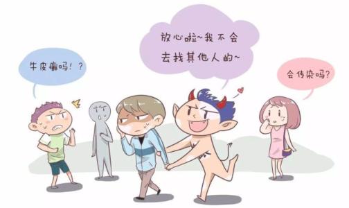 广州治疗医院检查牛皮癣的要点有哪些