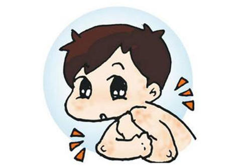 在家脓疱型银屑病应该如何治疗呢